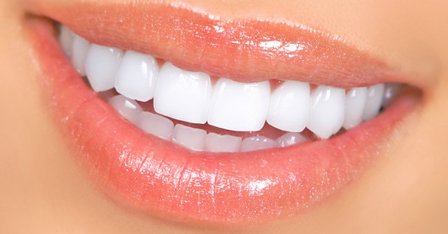Un golpe en un diente puede causar la muerte del nervio