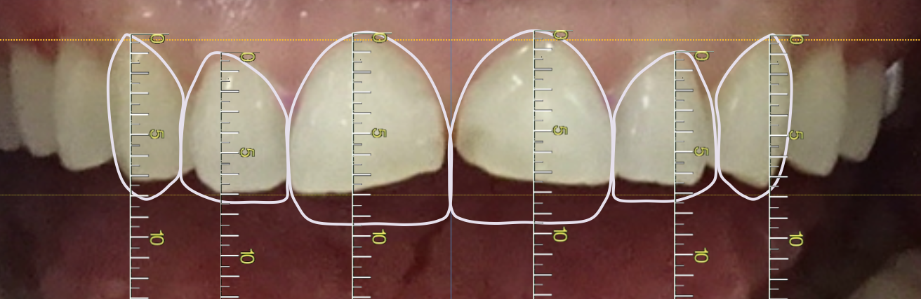 El diseño digital de la sonrisa