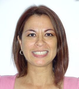 Este tratamiento supera las expectativas de los pacientes.