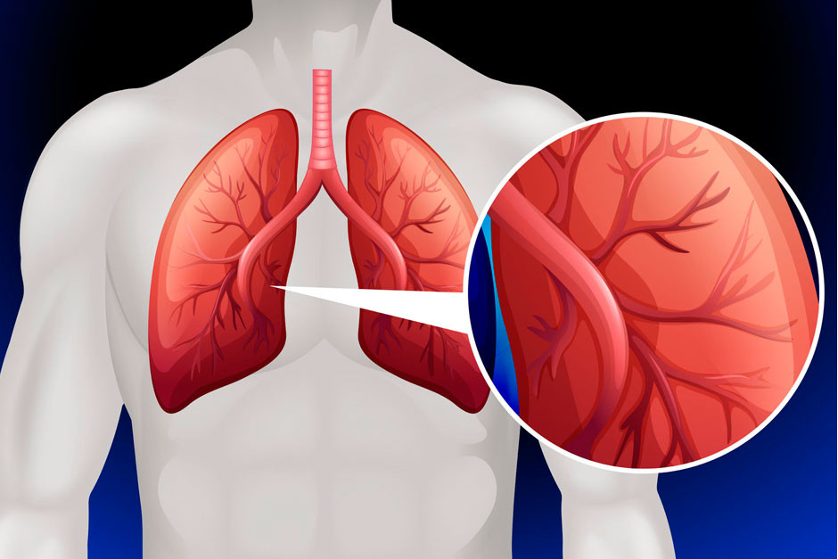 Diagnóstico y tratamiento claves en la vida de un paciente con hipertensión pulmonar