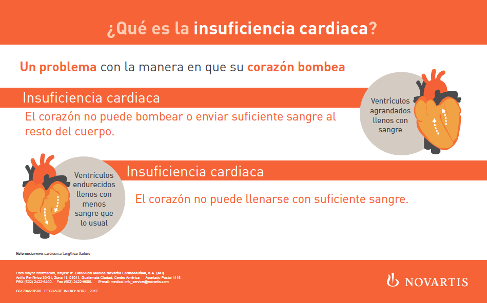 ¿Qué es la Insuficiencia Cardiaca?