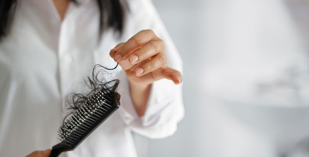 ¿Cómo detectar la alopecia a tiempo?