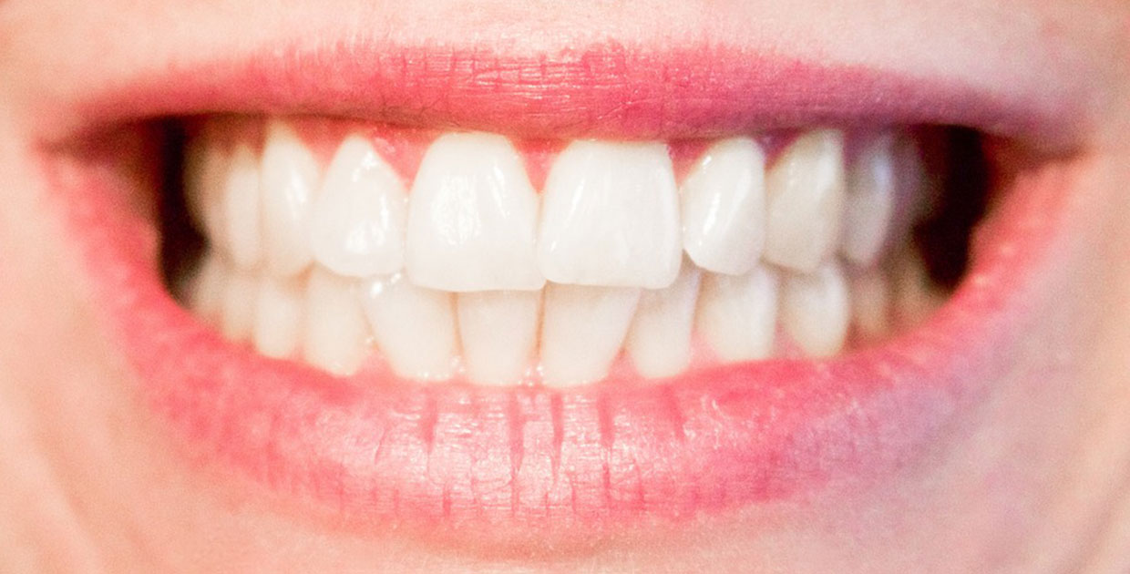 ¿Está en los dientes la causa de su enfermedad?