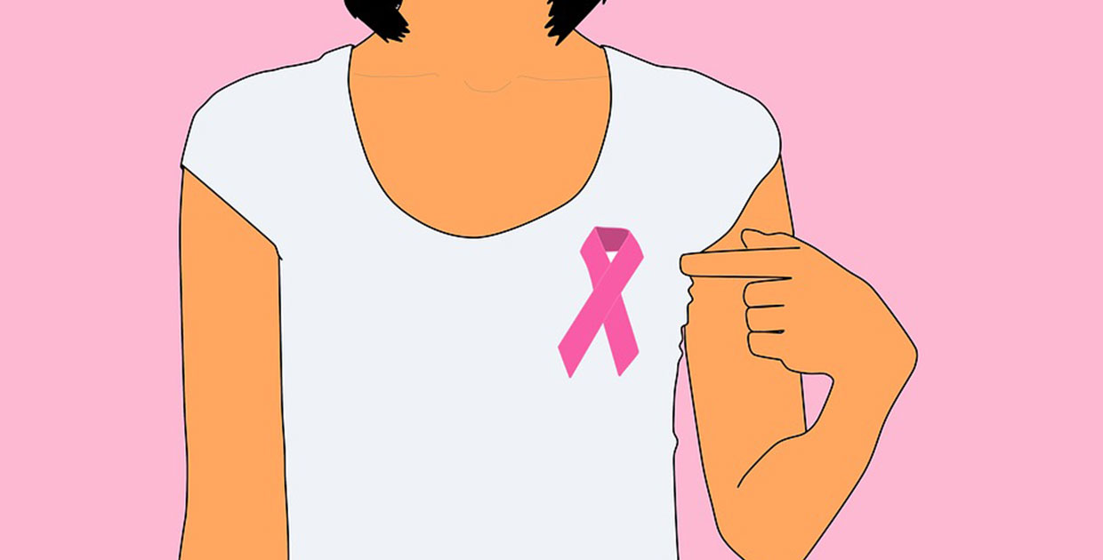Adoptan medidas para mejorar el cuidado de los pacientes de cáncer de mama metastásico