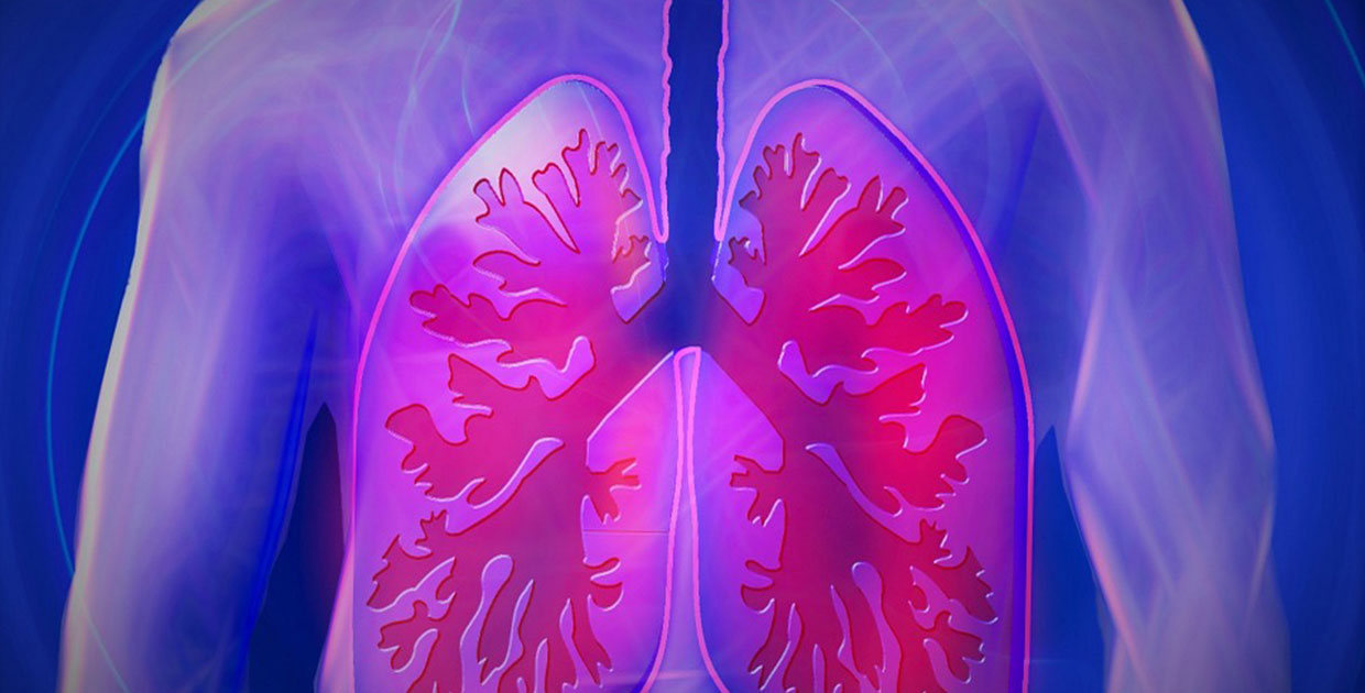 Médicos ofrecen recomendaciones actualizadas para la Enfermedad Pulmonar Obstructiva Crónica