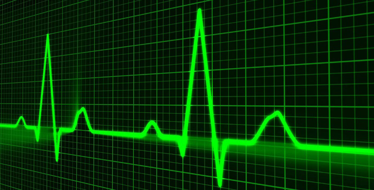 Mayo Clinic usa inteligencia artificial para detectar problemas cardiacos