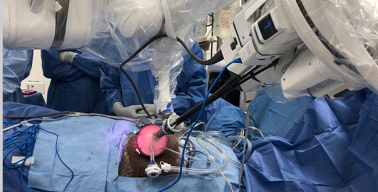 Cleveland Clinic es la primera en el mundo en realizar un trasplante de riñón por sistema robótico de puerto único