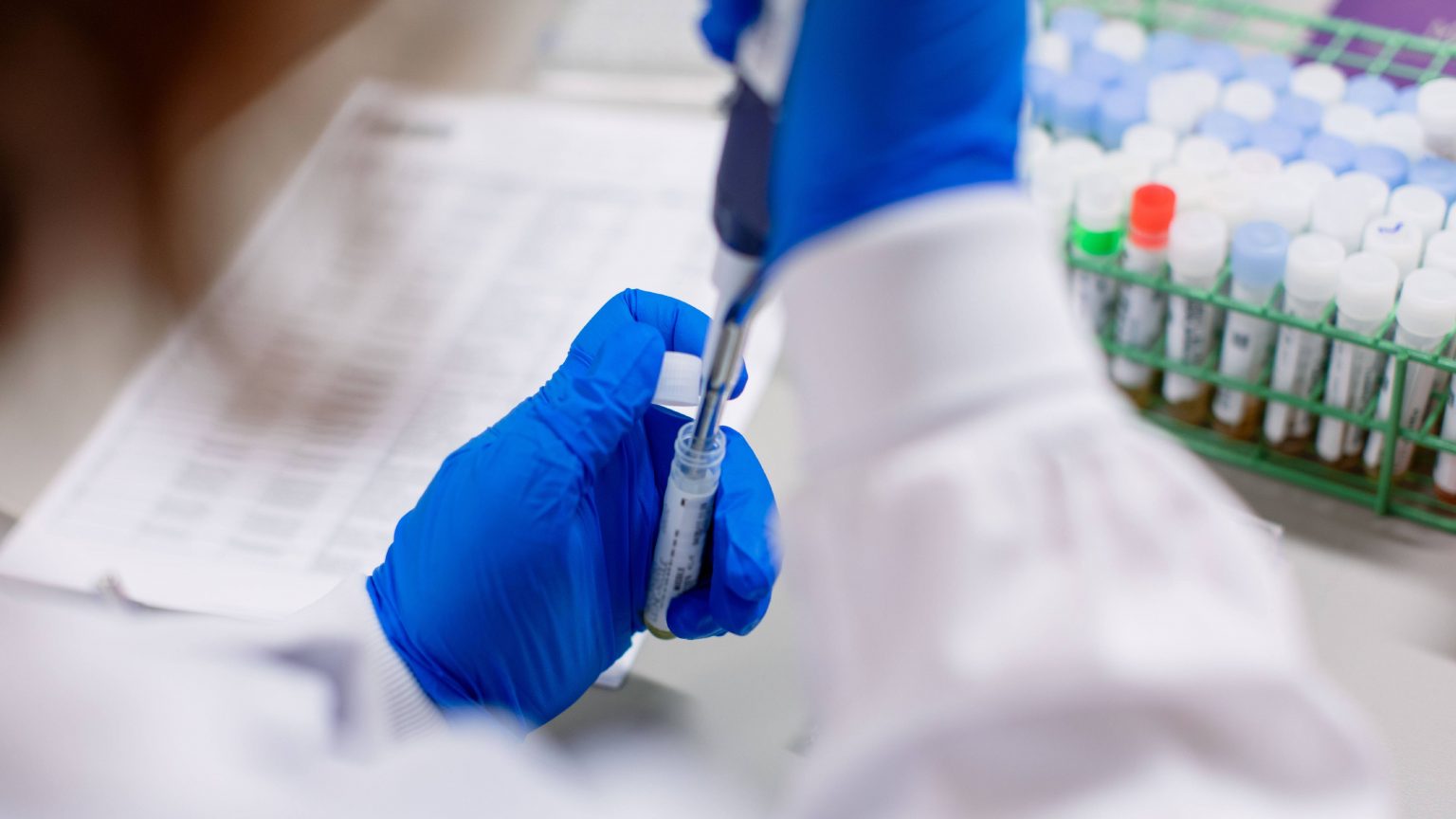 Un medicamento para reducir el colesterol podría convertir el Covid-19 en un resfriado común