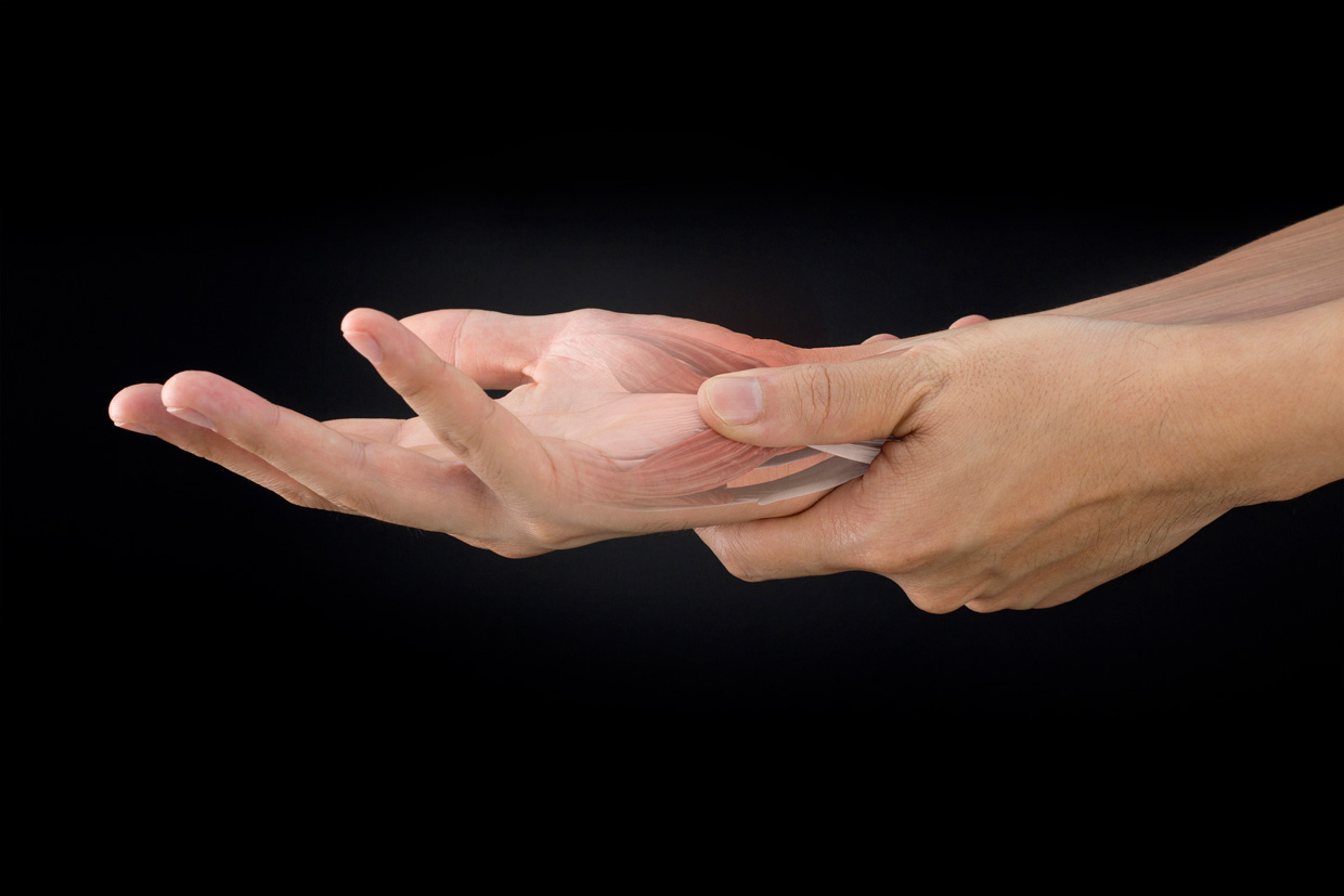 La Artritis Reumatoide y su impacto en la vida de los pacientes