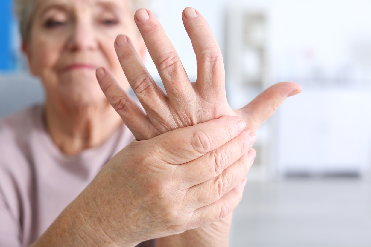 La artritis reumatoide es 2,5 veces más común en mujeres