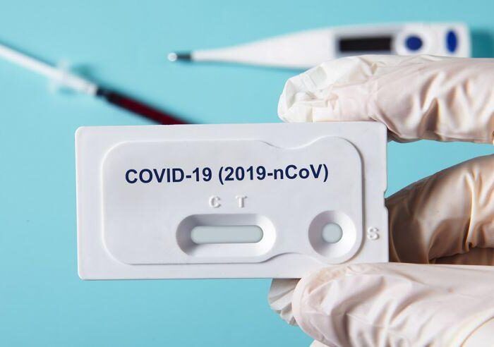 Laboratorios Echandi recibe autorización para la importación de pruebas antígenos