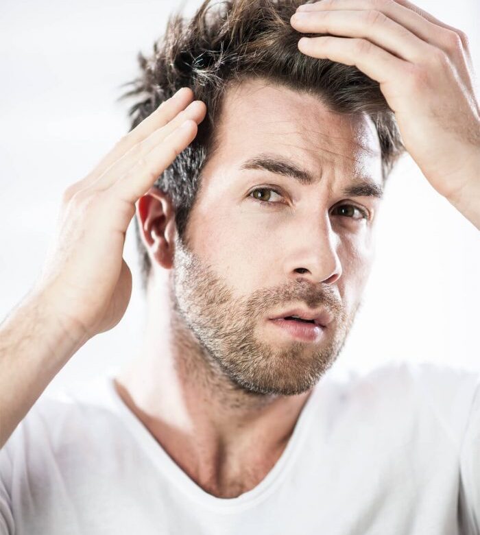 Pérdida excesiva de cabello: una señal silenciosa de estrés