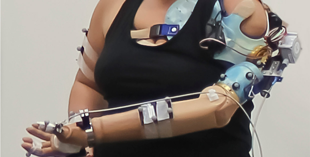Investigadores Cleveland Clinic desarrollan un brazo biónico para pacientes con amputaciones de miembros superiores