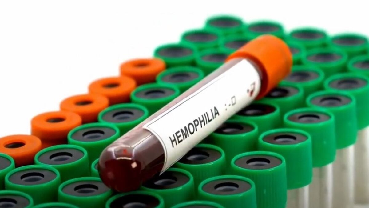 Acceso a la innovación: elemento clave para la calidad de vida de pacientes con hemofilia