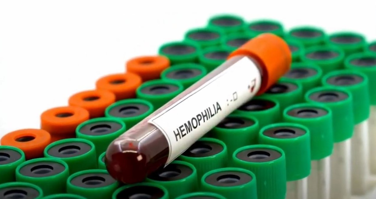 Programa especial visibilizará el contexto de las Personas con Hemofilia en Costa Rica