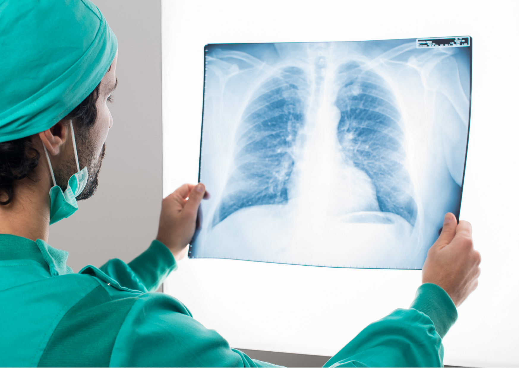 Claves para el diagnóstico temprano de cáncer de pulmón en el marco del COVID-19