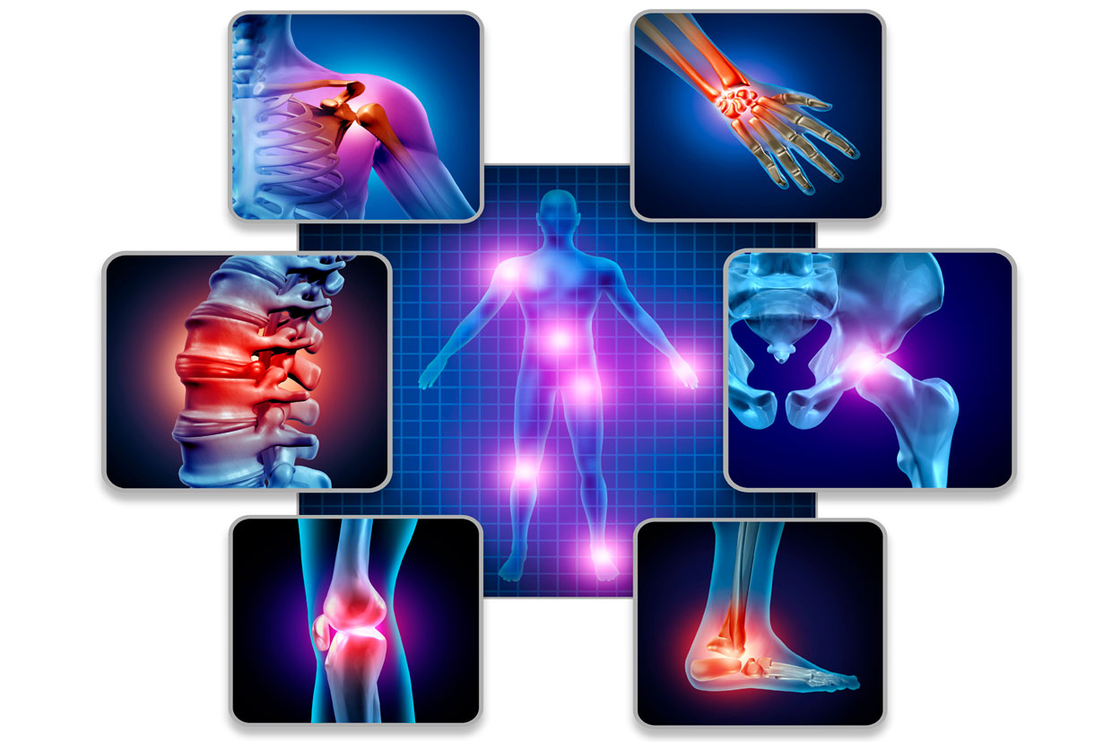 ¿Ser mujer es sinónimo de Osteoartritis?