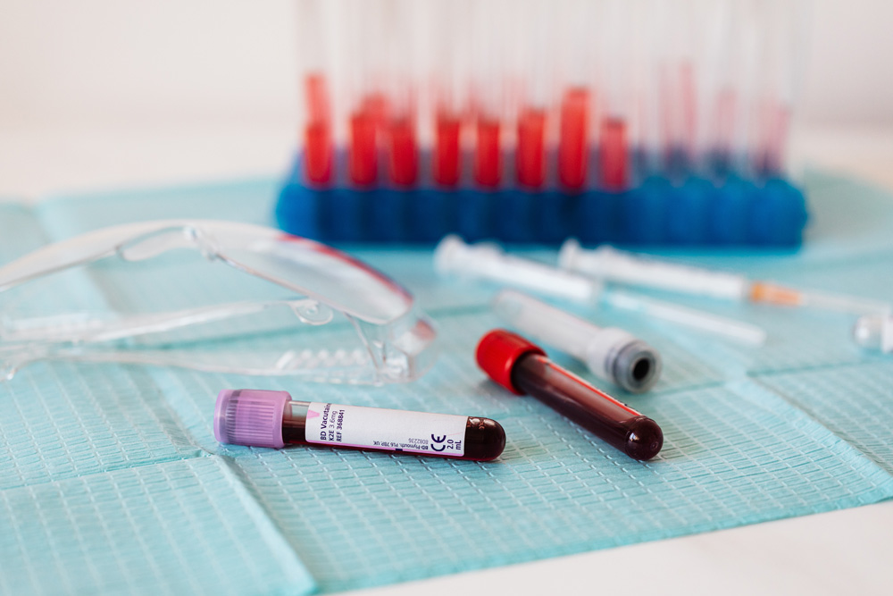 ¿Ayunar para un análisis de sangre es realmente necesario?