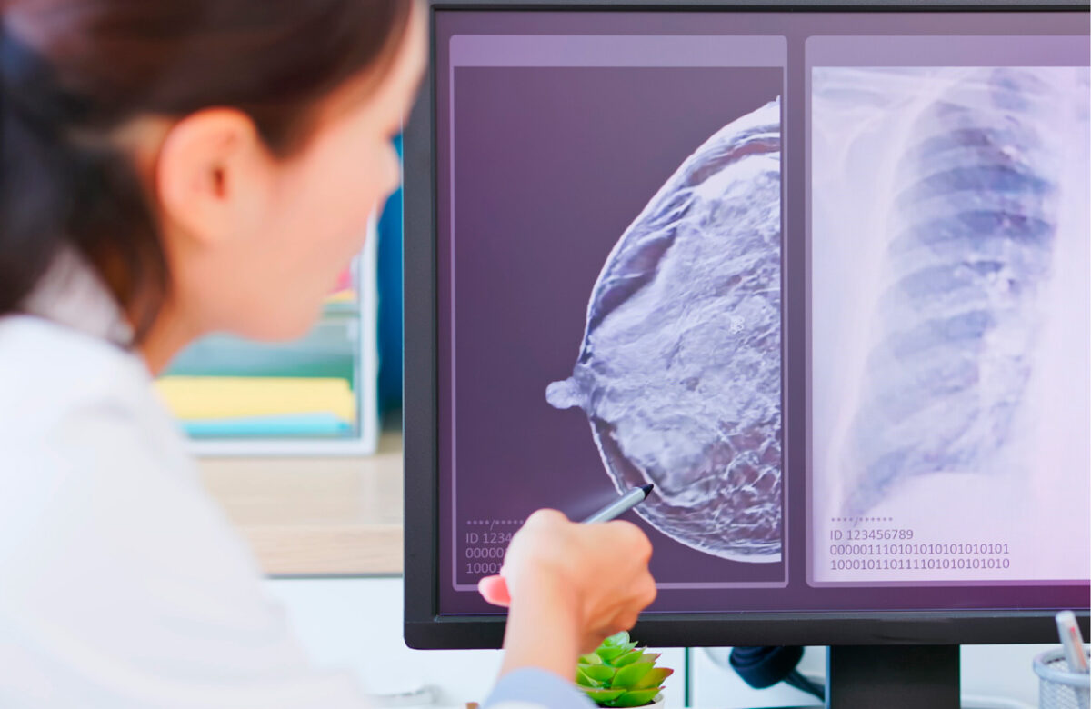 Detección temprana e innovación médica abren nuevas oportunidades frente al cáncer de mama en Costa Rica