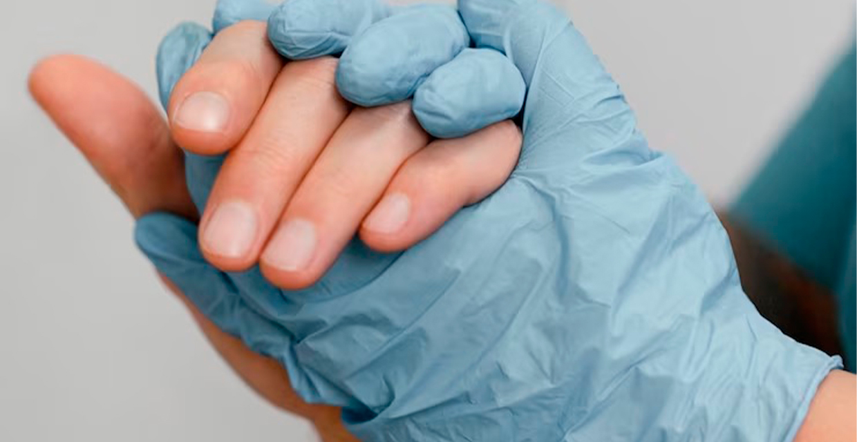 ¿Qué desencadena el dedo en gatillo?