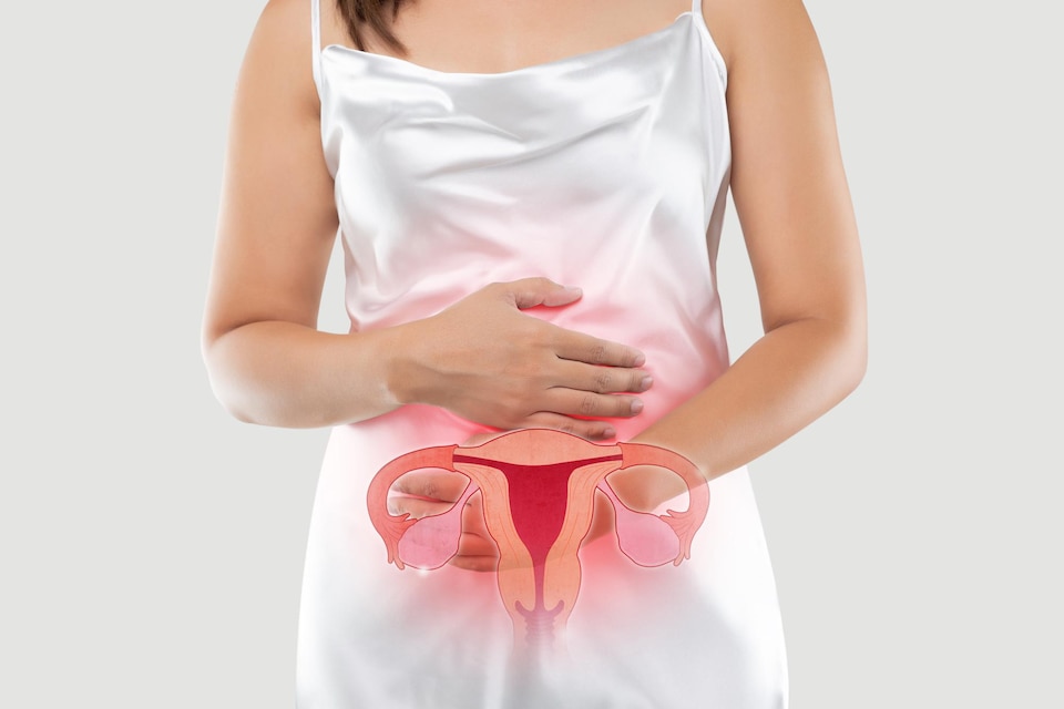 Entre el 30 y el 50% de mujeres con endometriosis tienen problemas de fertilidad