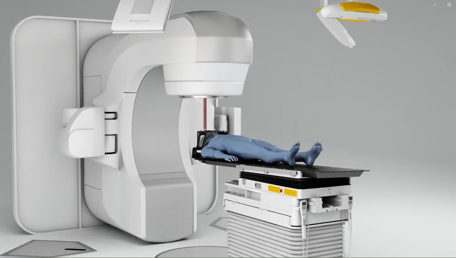 Inteligencia Artificial y Radiocirugía se unen para mejorar pronóstico  de pacientes con cáncer
