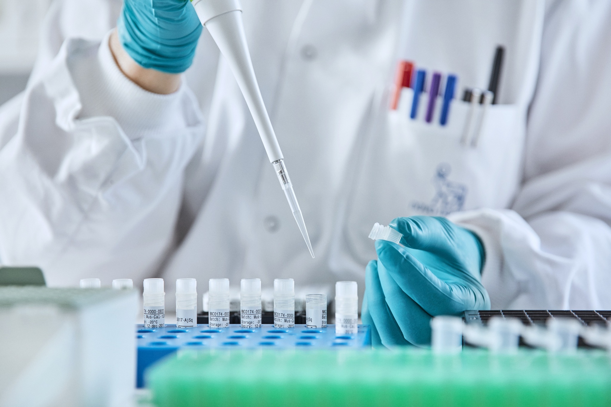 La prevención sigue siendo la gran deuda frente a la diabetes en Costa Rica