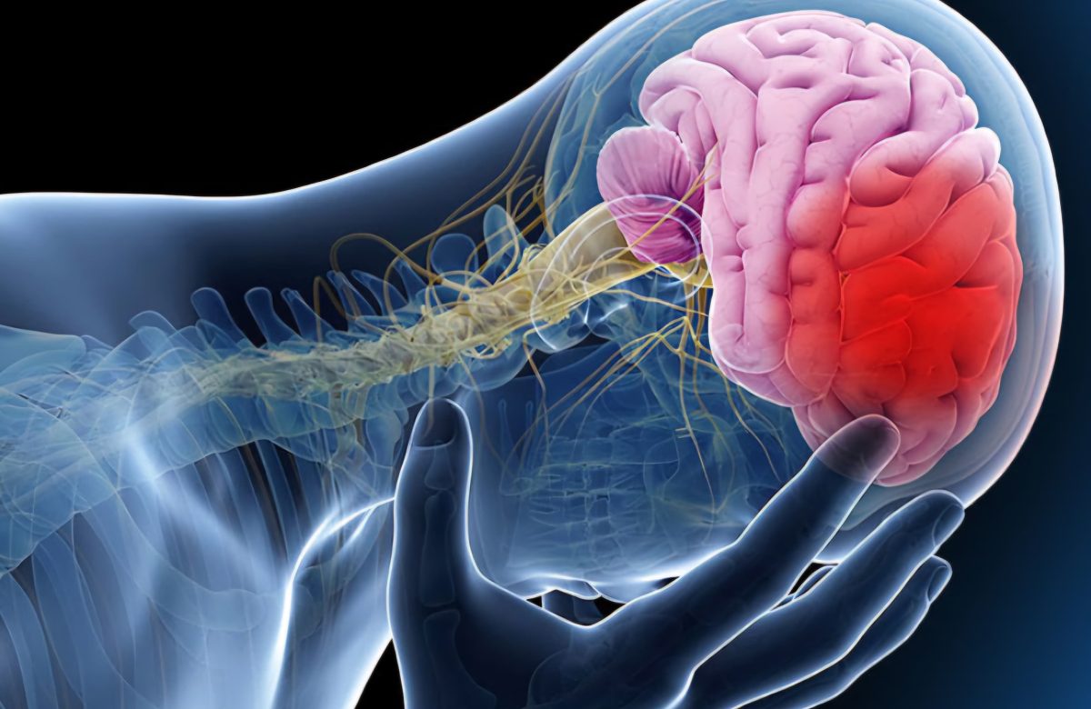 El cerebro podría intensificar las crisis epilépticas durante el sueño, según estudio de Mayo Clinic