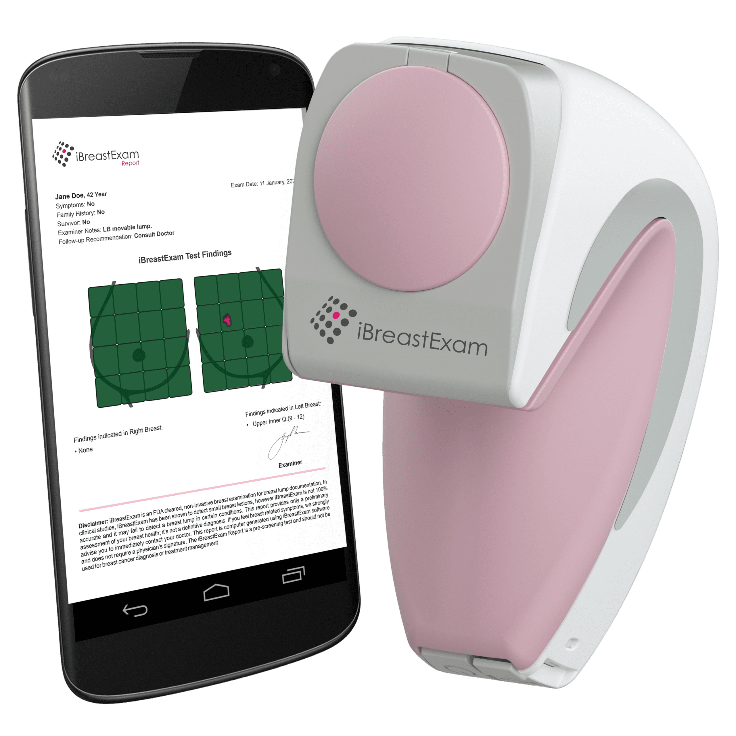 Ibreastexam llega a Guatemala para fortalecer la detección temprana del cáncer de mama