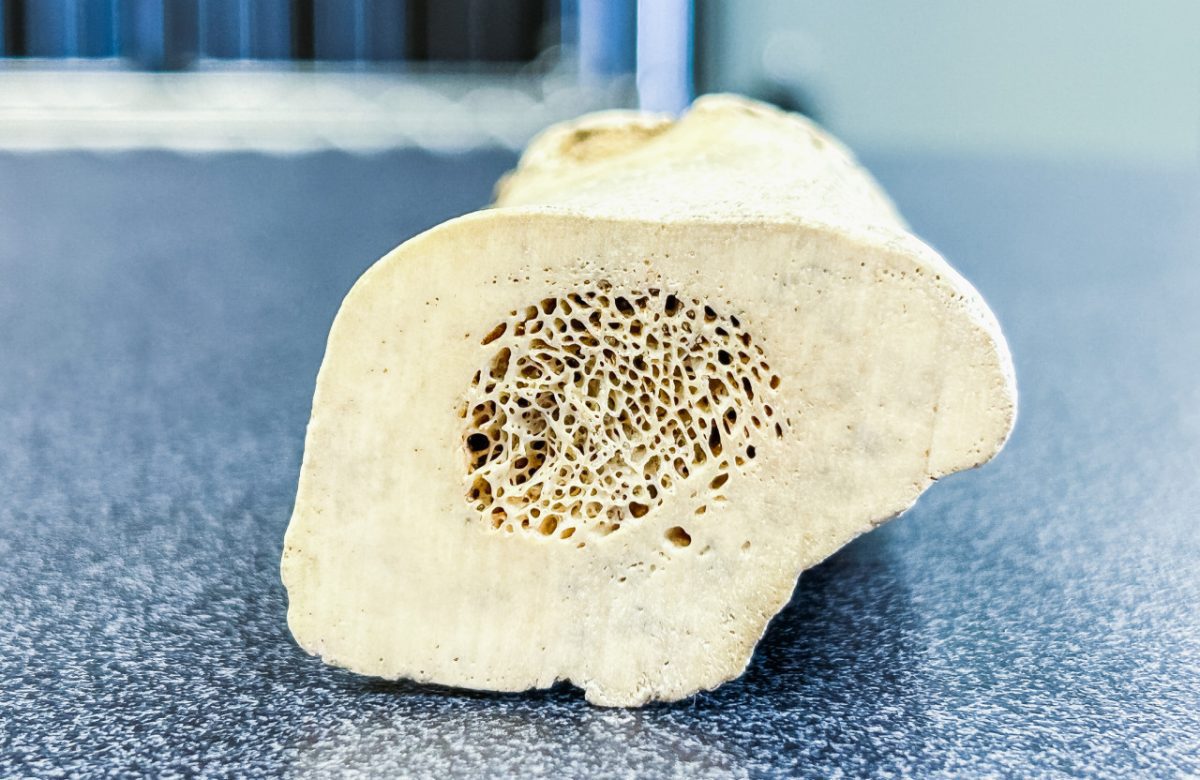 Implantes ortopédicos personalizados y bioabsorbibles, investigación del TEC contribuye a la medicina