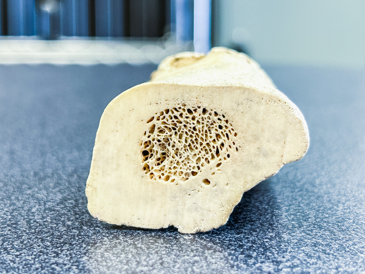 Implantes ortopédicos personalizados y bioabsorbibles, investigación del TEC contribuye a la medicina