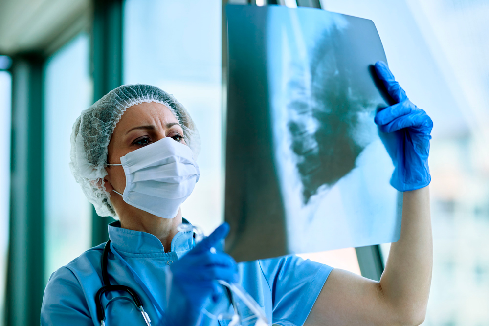 Intervención temprana es el mayor desafío en la atención de la fibrosis pulmonar idiopática