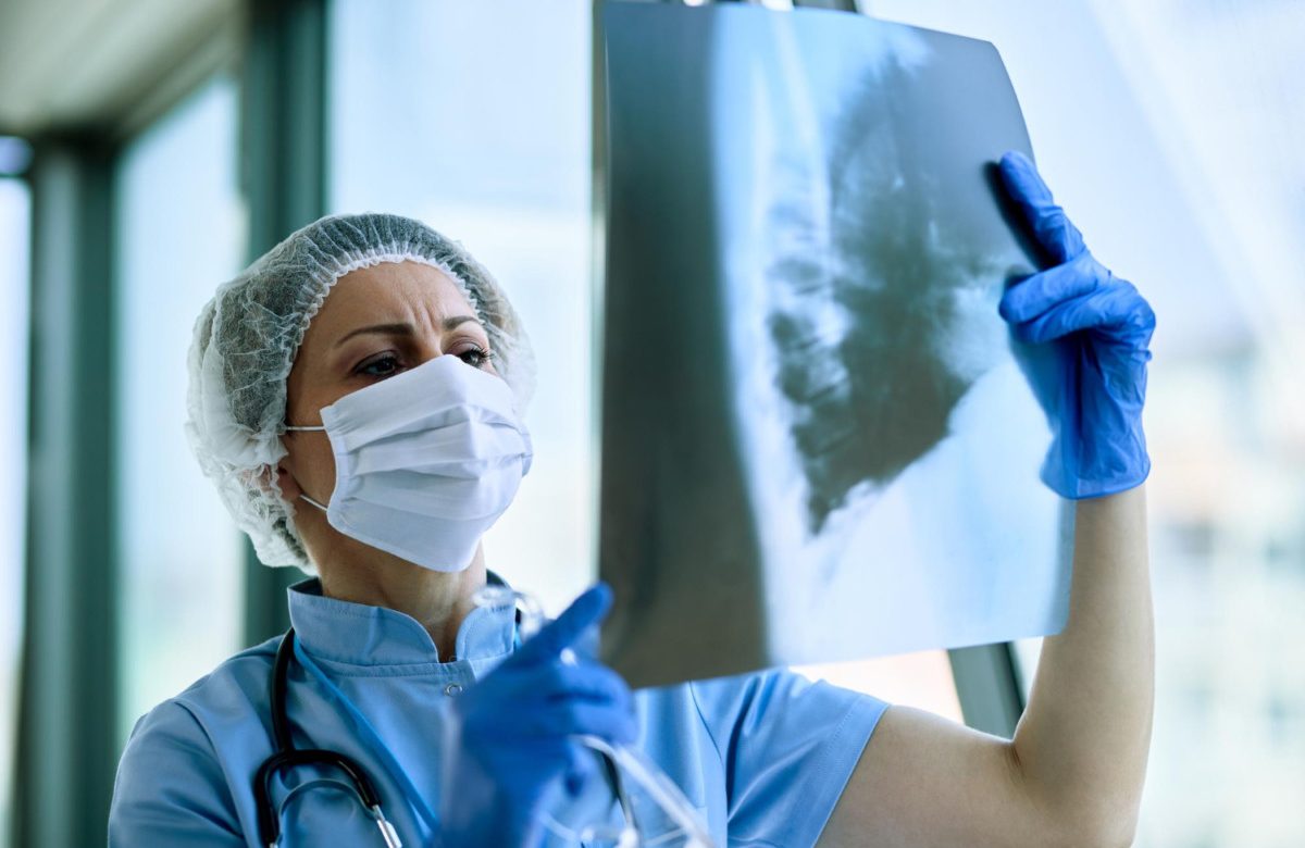 La OMS impulsará una nueva estrategia mundial contra la tuberculosis