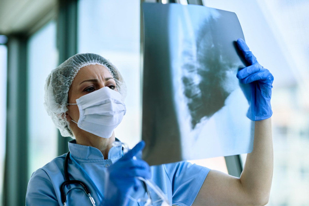 La OMS impulsará una nueva estrategia mundial contra la tuberculosis