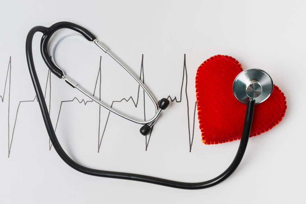 ¿Es mi corazón acelerado una arritmia?