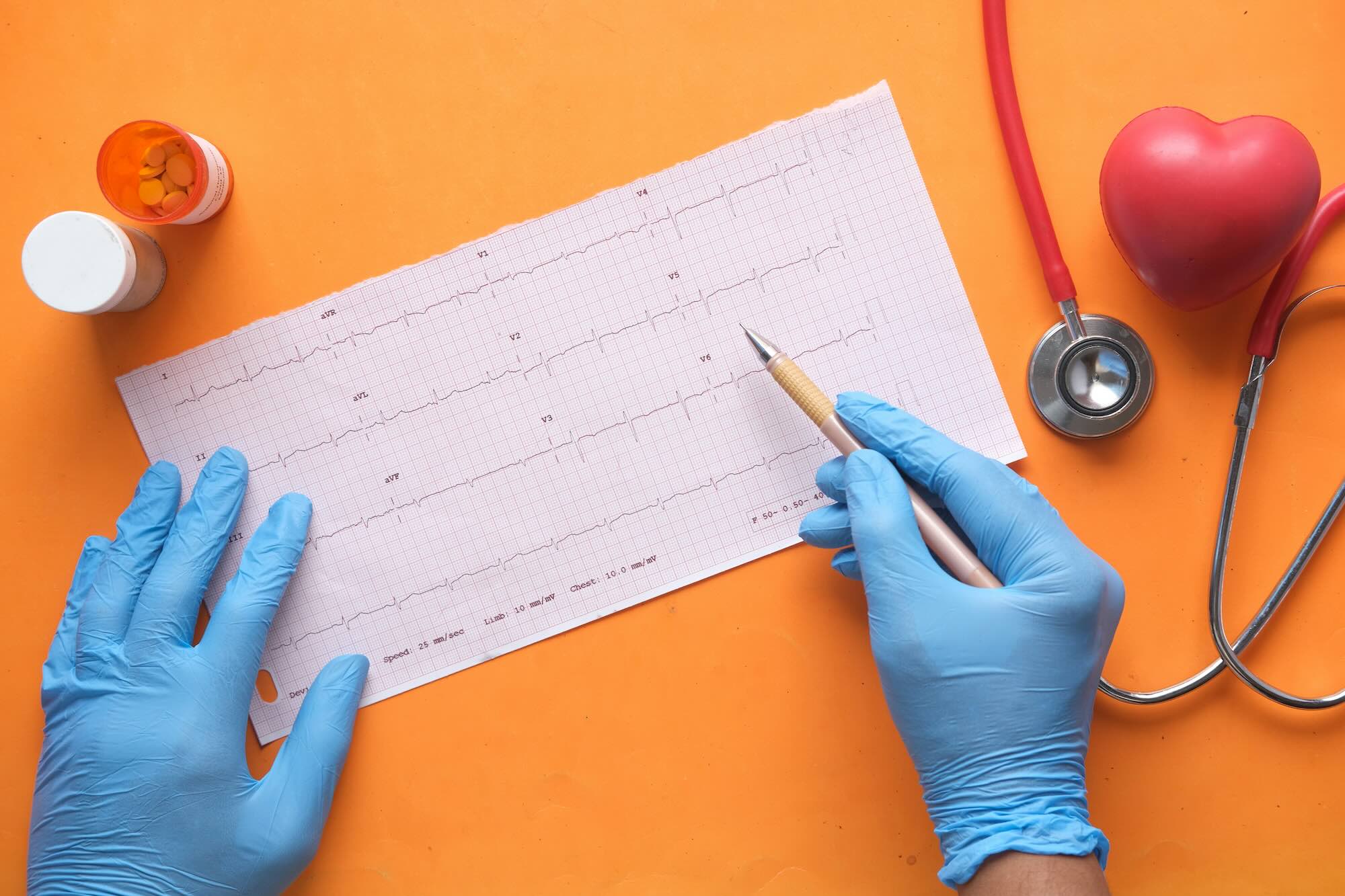 Hábitos cotidianos que influyen directamente en la salud cardíaca