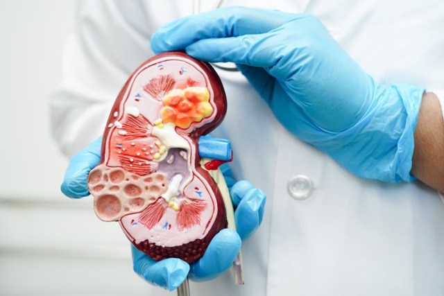 Nueva opción terapéutica busca mejorar el control de la hiperkalemia