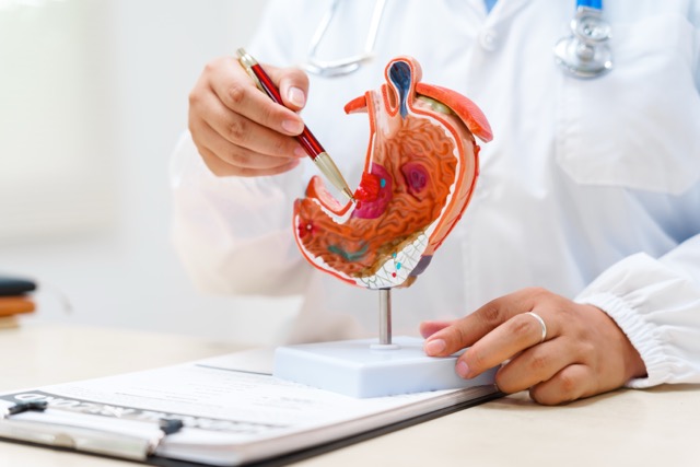 Estudio identifica avances en el tratamiento del cáncer gástrico